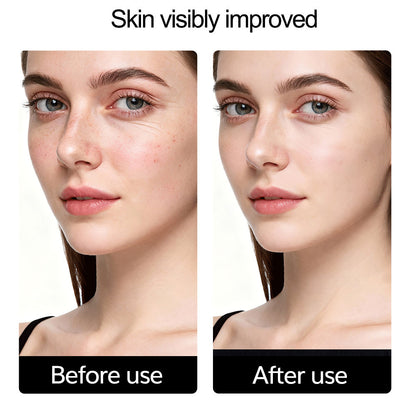 Wireless LED Light Therapy Mask | 7-Color Light Therapy For Wrinkles, Acne & Dullness - GlowLife